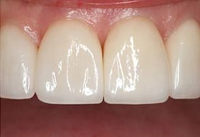 Eric C. Green, DDS | Night Guards, Crowns  amp  Caps and Oral Exams