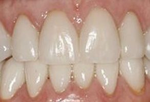 Eric C. Green, DDS | Dentures, Crowns  amp  Caps and Night Guards