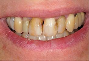 Eric C. Green, DDS | Oral Exams, Crowns  amp  Caps and Night Guards